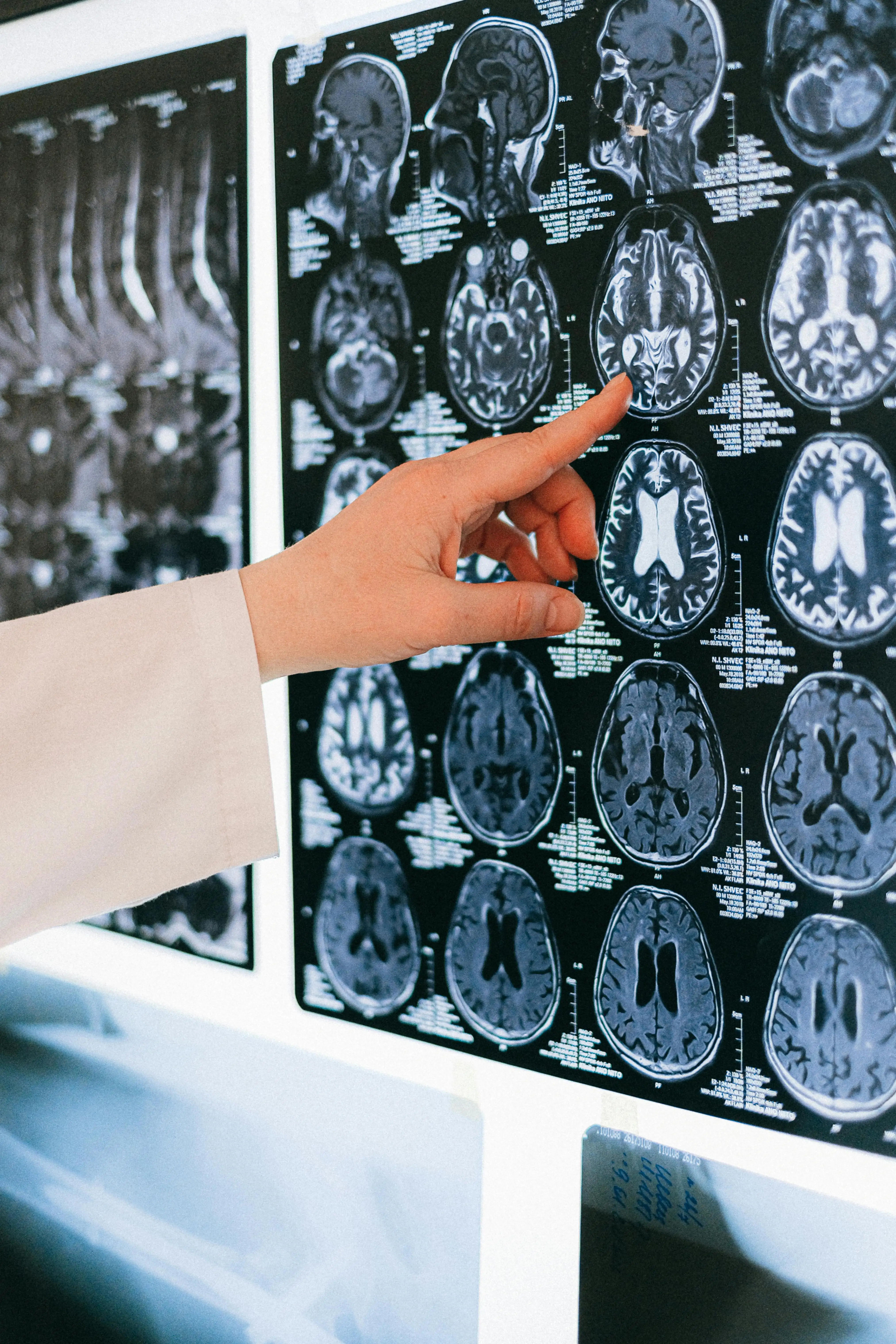 Brain Restore & Brain Health treatment at Integrative Health Solutions in Florence SC